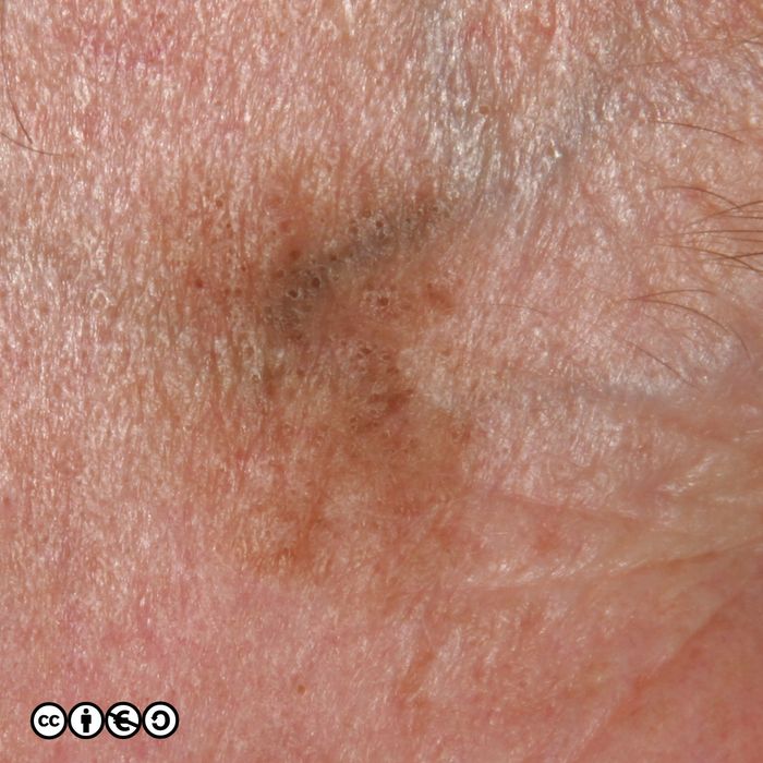 B281final 700px