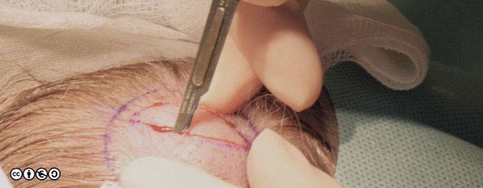 surgery image 002 700px