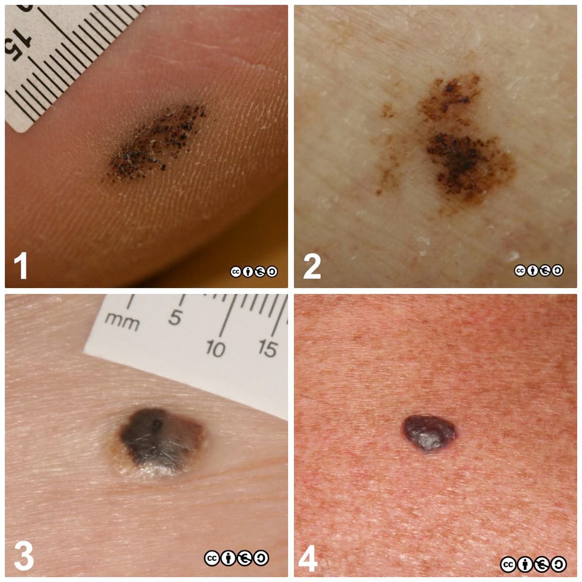 composite 2 trial