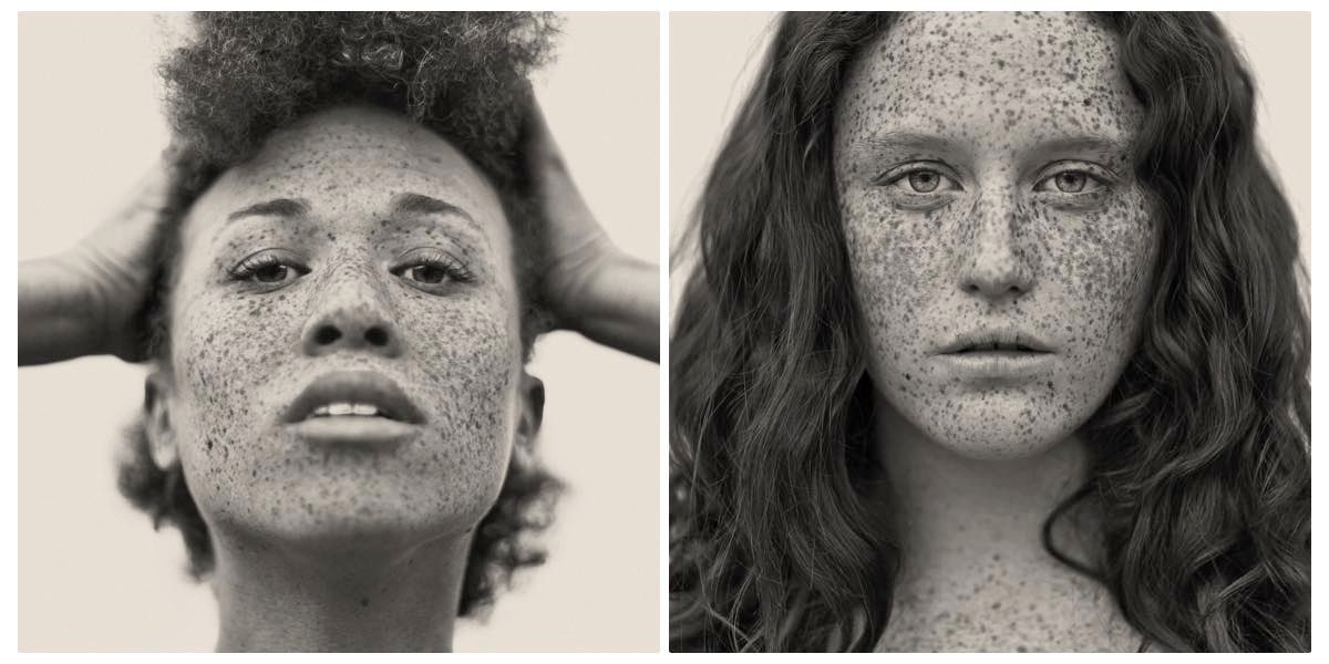 freckles reto caduff