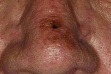 figure-small-7-3a